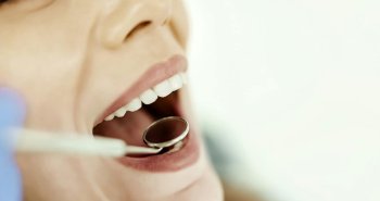 Jak często chodzić do dentysty na kontrolę stanu uzębienia?