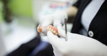 Od czego zależy cena implantów zębowych?
