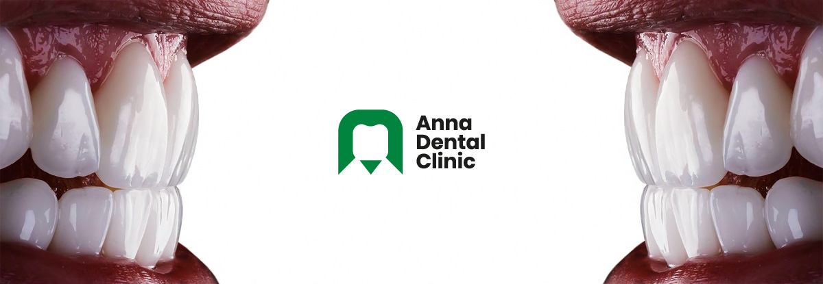 Anna Dental Clinic Offer 01 01 01
