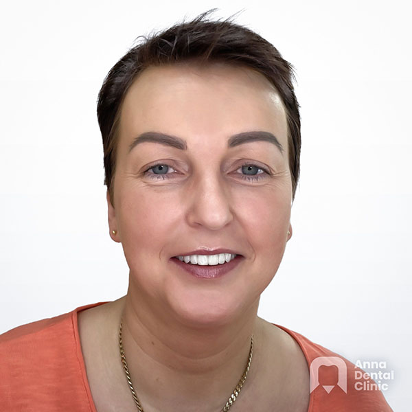 Smile Makeover | Anna