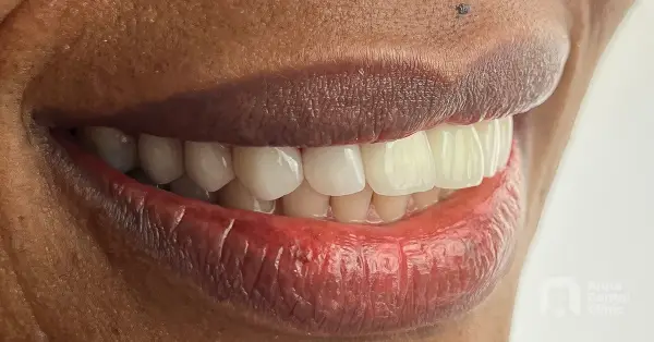 Metamorfoza uśmiechu