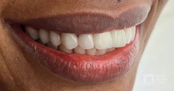 Metamorfoza uśmiechu