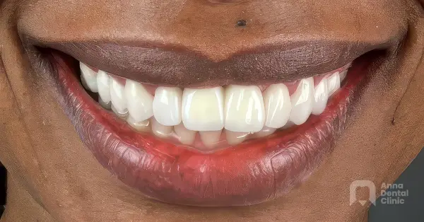 Metamorfoza uśmiechu