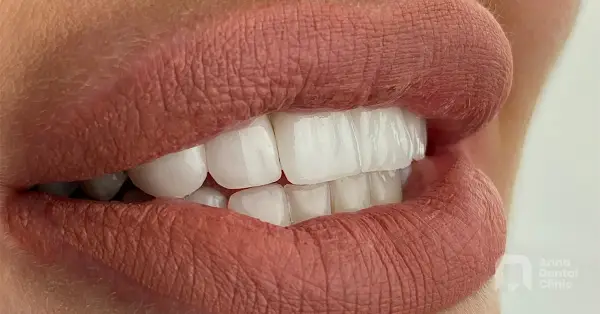 Metamorfoza uśmiechu