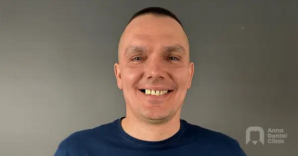 Metamorfoza uśmiechu