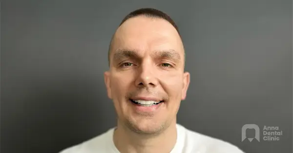 Metamorfoza uśmiechu