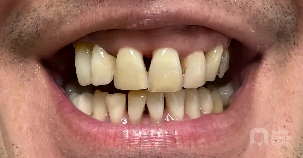 Metamorfoza uśmiechu