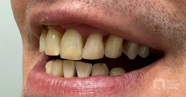 Metamorfoza uśmiechu