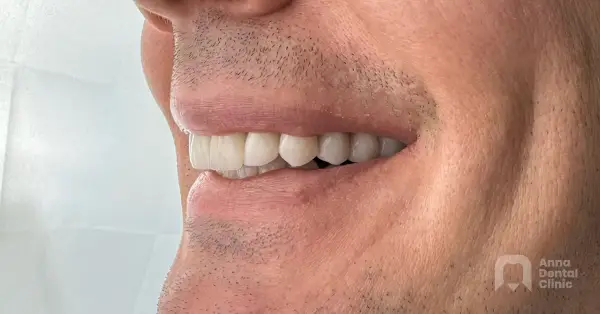 Metamorfoza uśmiechu