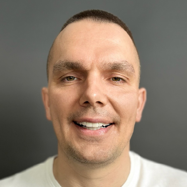 Smile gallery | Łukasz