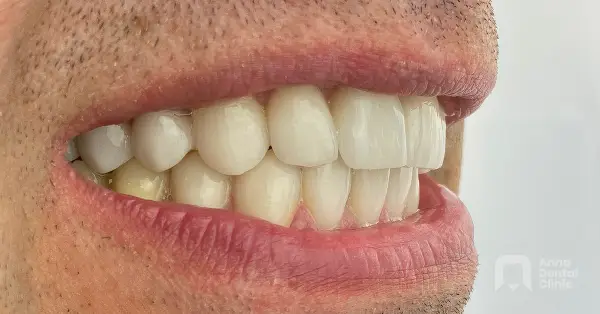 Metamorfoza uśmiechu