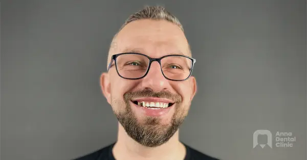 Metamorfoza uśmiechu