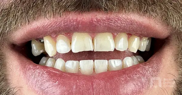 Metamorfoza uśmiechu