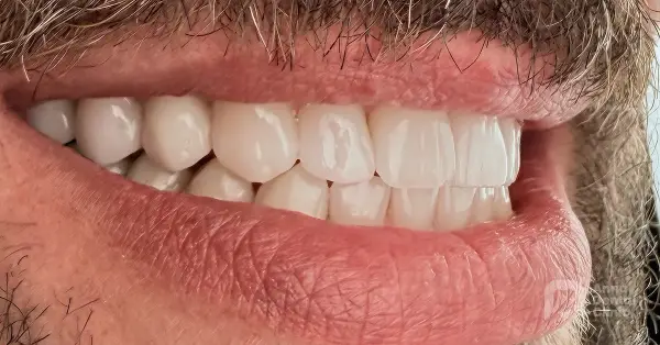 Metamorfoza uśmiechu