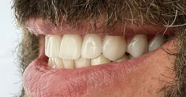 Metamorfoza uśmiechu