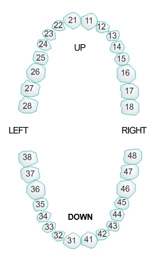 Model of the upper and lower dental arch