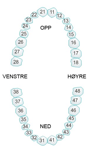 Modell av øvre og nedre tannbue.
