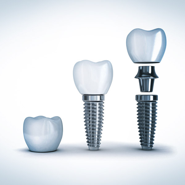 Tannimplantat